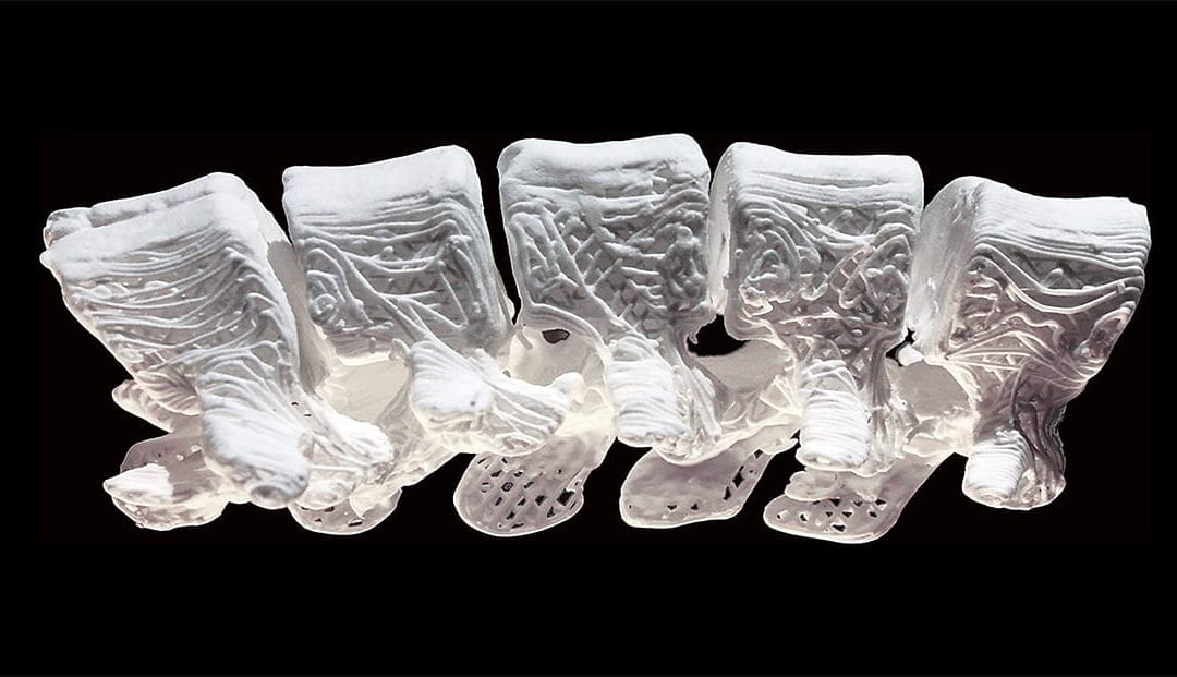 3D printed bone may hold key to treating birth defects and accidents